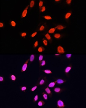TriMethyl-Histone H3-K27 mAb