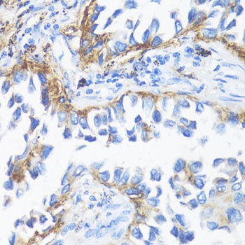 HLA-DRB3 Antibody