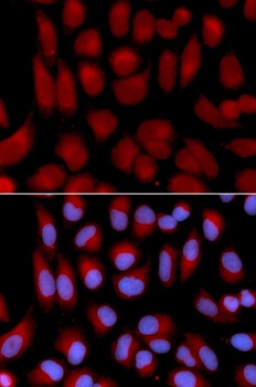 TAP2 Antibody