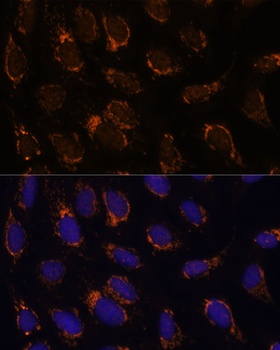 TSFM Antibody