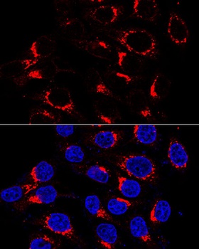 USO1 Antibody