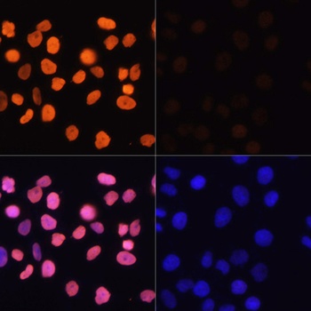 H3K4ac Antibody