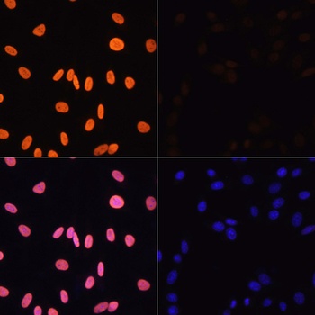 H3K4ac Antibody