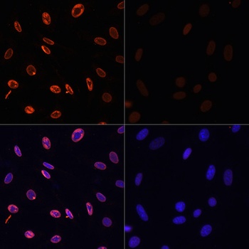 Acetyl-Histone H3-K36 pAb