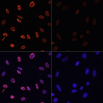 H3K36ac Antibody