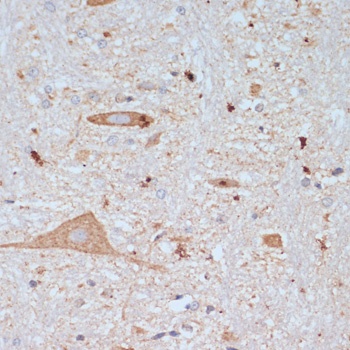 SLC18A3 Antibody