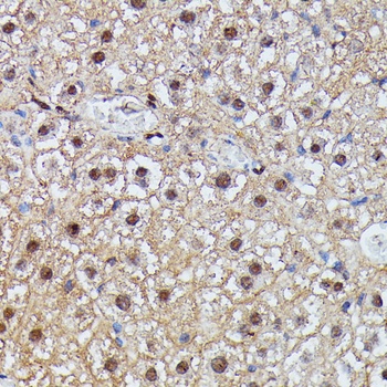 IGHMBP2 Antibody