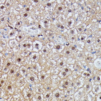 IGHMBP2 Antibody