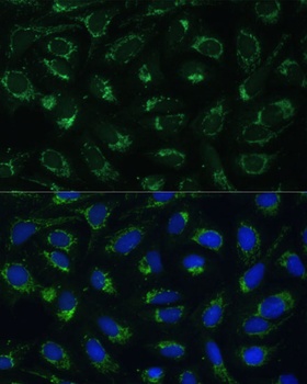 ETFB Antibody