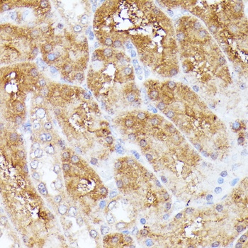 CLNS1A Antibody