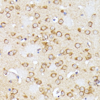 CLNS1A Antibody