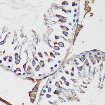 Cyclin B1 Antibody