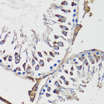 CCNB1 Antibody