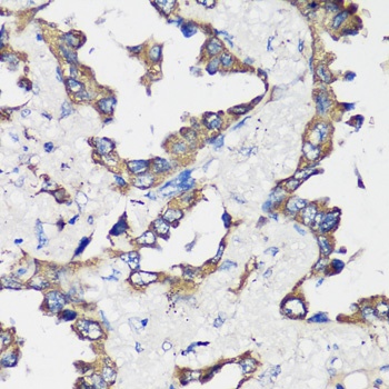 Cyclin B1 Antibody