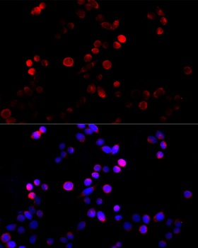 Cyclin B1 Antibody