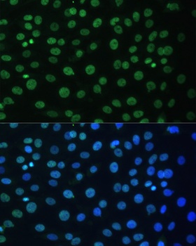 Cyclin B1 Antibody