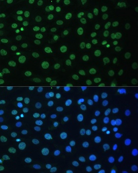 CCNB1 Antibody