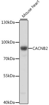 CACNB2 Antibody