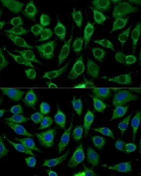 ABCD2 Antibody