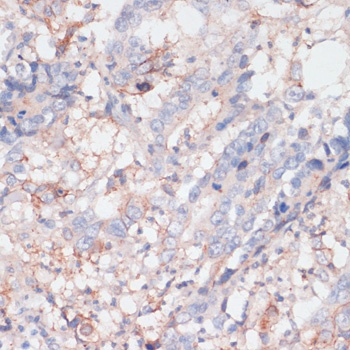 ZNRF3 Antibody