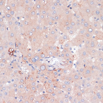 ZNRF3 Antibody