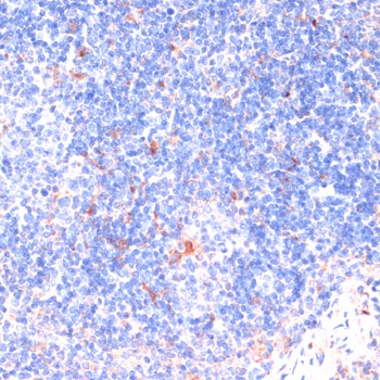 ZNRF3 Antibody