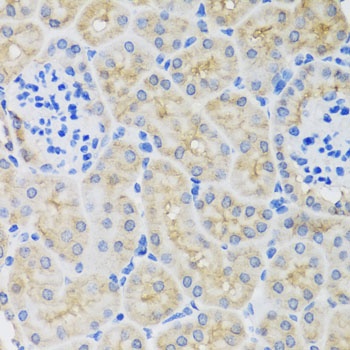 SULT1A1 Antibody