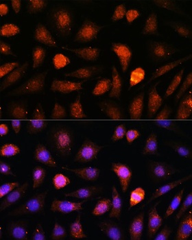 CDK5RAP1 Antibody