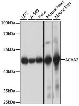 ACAA2 Antibody