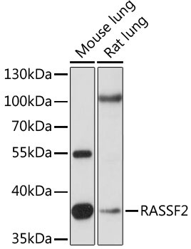 RASSF2 Antibody