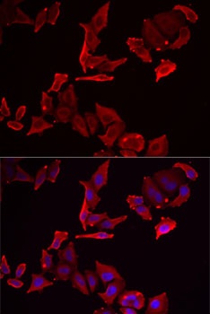 SKAP2 Antibody