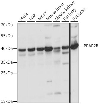 PPAP2B Antibody