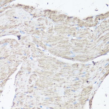 VDAC1 / Porin Antibody