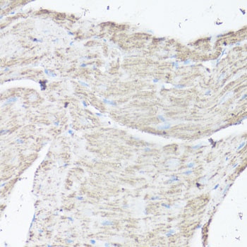 VDAC1 Antibody