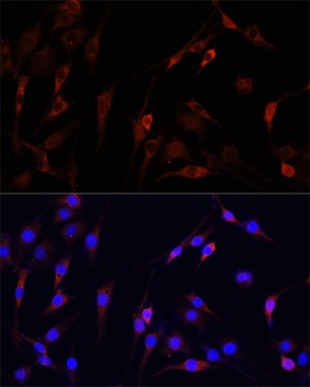 VDAC1 / Porin Antibody