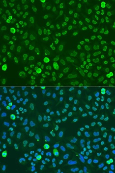 SAFB Antibody