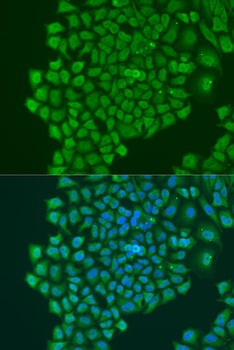 YBX1 Antibody