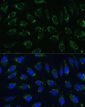 NDUFA4 Antibody