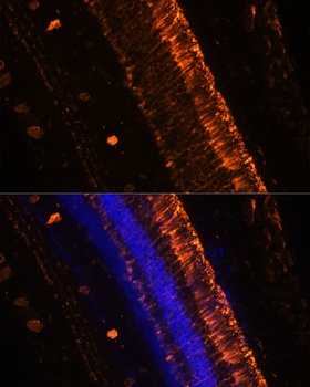 KCNS2 Antibody