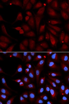 MAOB Antibody