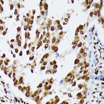 HNRNPD Antibody