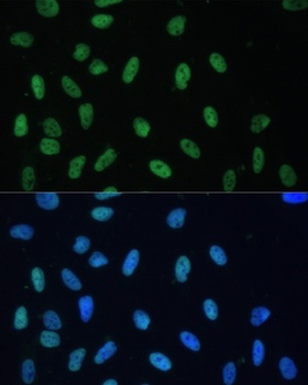 HNRNPD Antibody