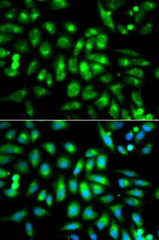 CHRM2 Antibody