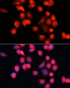 SLC25A5 Antibody