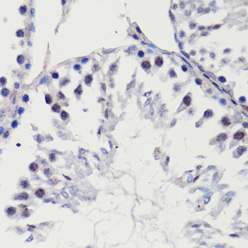 p27 KIP 1 Antibody