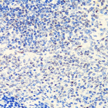 p27 KIP 1 Antibody