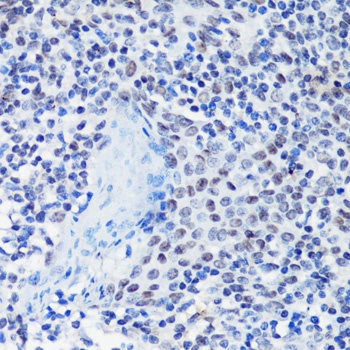 p27 KIP 1 Antibody