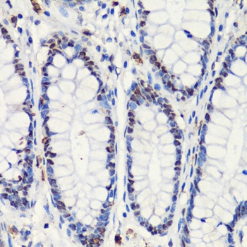 p27 KIP 1 Antibody