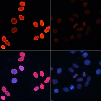p27 KIP 1 Antibody