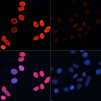 CDKN1B Antibody